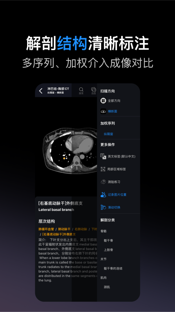 影像解剖图谱 v4.4.1