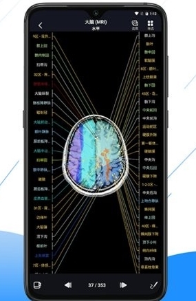 影像解剖图谱