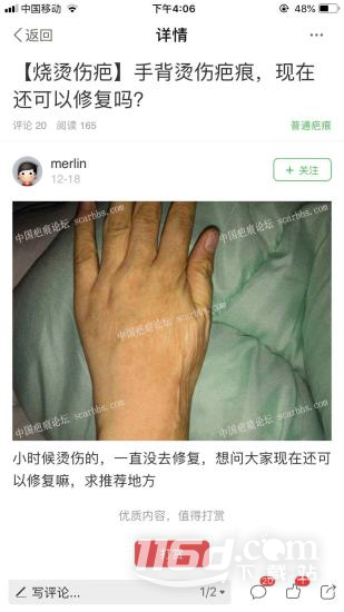 中国疤痕论坛
