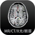 影像解剖图谱app v4.4.3