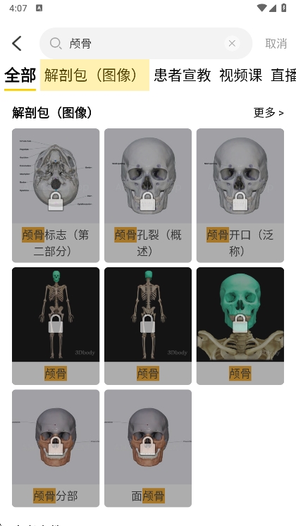 怎么看小脑配图1