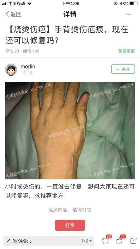 中国疤痕论坛4