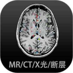 影像解剖图谱手机软件