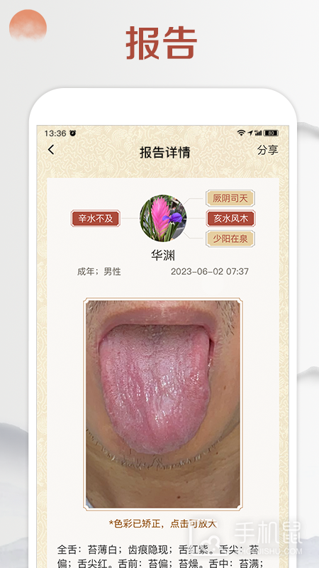 看舌头 v3.3.13