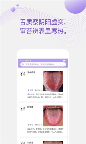 看舌头2