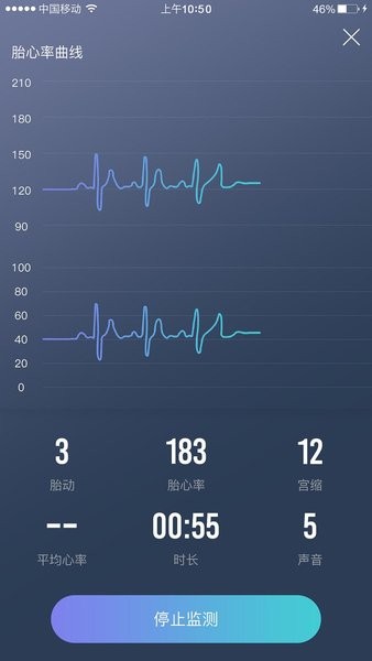 朵尔监护app V2.1.5