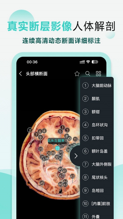 掌上3D解剖1